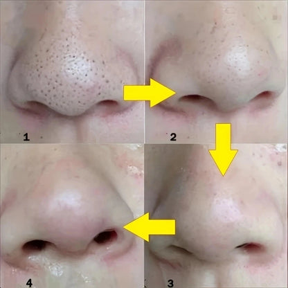 Clear Pores Nose Strips