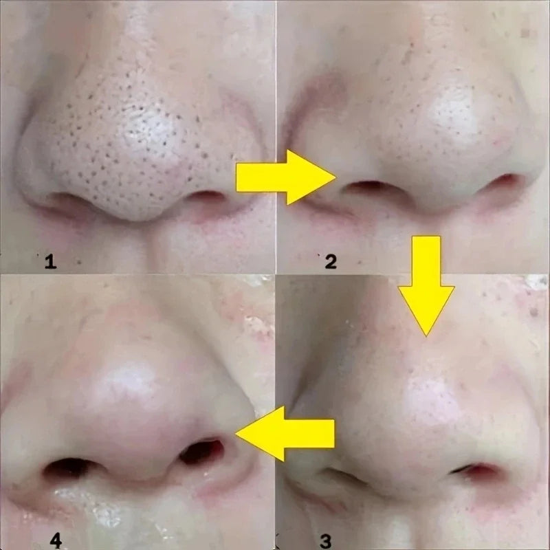 Clear Pores Nose Strips