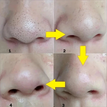 Clear Pores Nose Strips